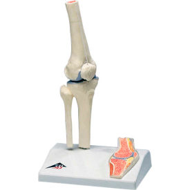 3B® Anatomical Model - Mini Knee Joint with Cross Section of Bone on Base 12-4518