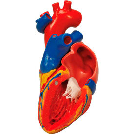 3B® Anatomical Model - Heart with Bypass 2-Part 12-4568
