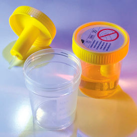 Graduated Transfer Top Urine Collection Cup with Transfer Device 4 oz. (120mL) Sterile 300/Pack 3856L