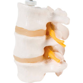 3B® Anatomical Model - 3 Lumbar Vertebrae Flexibly Mounted 12-4596