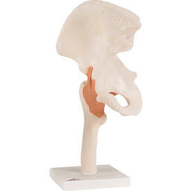 3B® Anatomical Model - Functional Hip Joint 12-4510