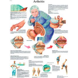 3B® Anatomical Chart - Arthritis Paper 12-4605P