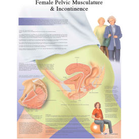 3B® Anatomical Chart - Female Urinary Incontinence Chart Laminated 12-4632L