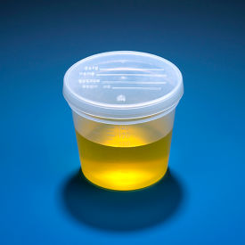 Graduated Specimen Container 5 oz.. Snap Cap Polypropylene 300/Pack 5917