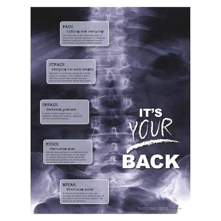 Safety Poster, X-Ray Its Your Back, 22 in H x, 17 in W, Paper MPN:P4450